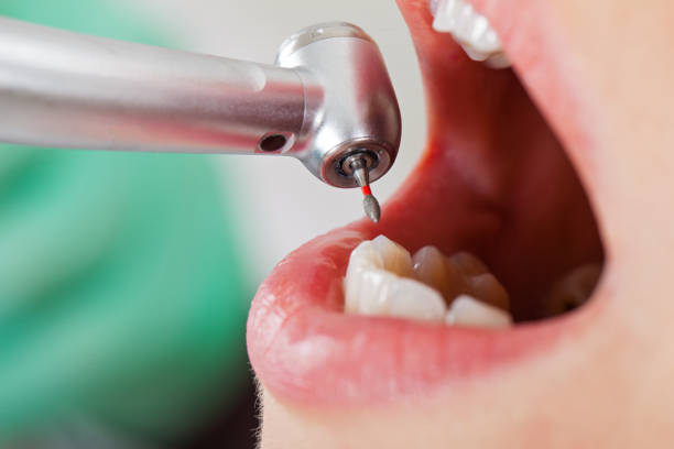 Best Tooth Pain Emergency Relief  in Elkridge, MD